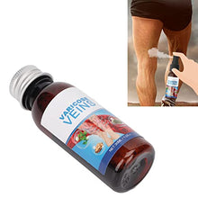 Load image into Gallery viewer, Varicose Spray, Spider Veins Spray Nozzle Massage for Home
